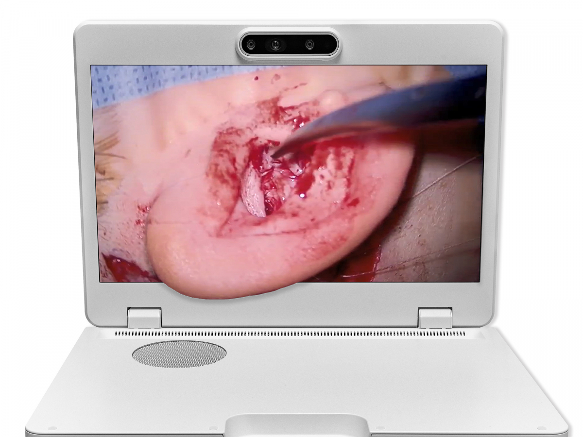 达擎之＂Heads-up 3D显微手术显示系统＂，整合4K裸眼3D显示及眼球追踪系统，具备快速追踪人眼移动位置功能，减轻医师长时间维持固定姿势的负担，让医师能有更宽广清晰的3D立体视野及更舒适的姿势来执行手术。